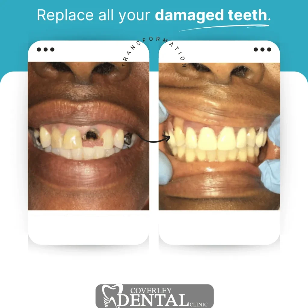Coverley Dental v3