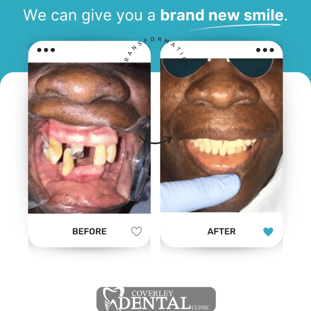 Coverley Dental v4